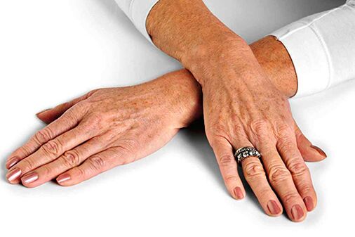 Hand skin with age-related changes needs to use rejuvenation techniques