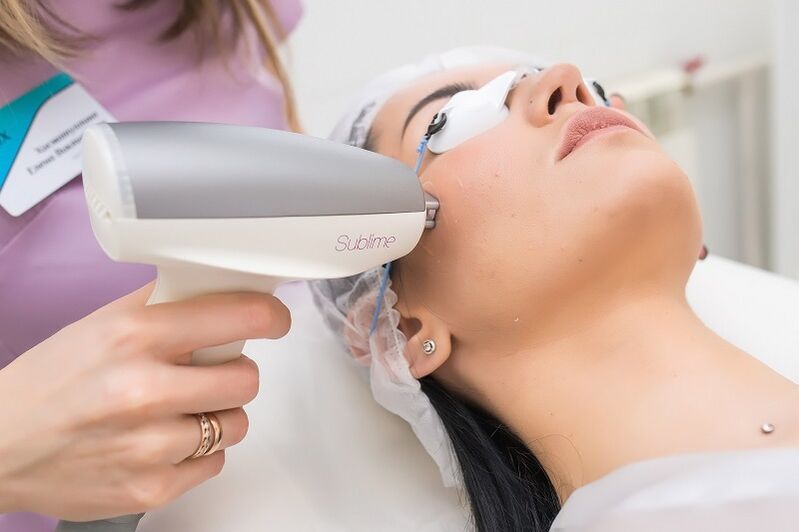 perform a laser skin rejuvenation procedure
